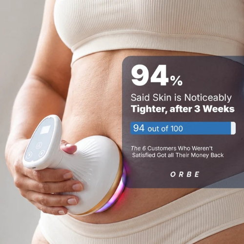 ORBE - Anti-cellulite Massager